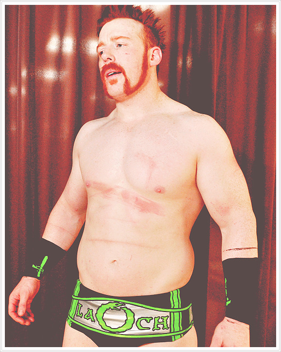 w4de-barrett:  Sheamus getting treated for his welts.  OUCH!!!