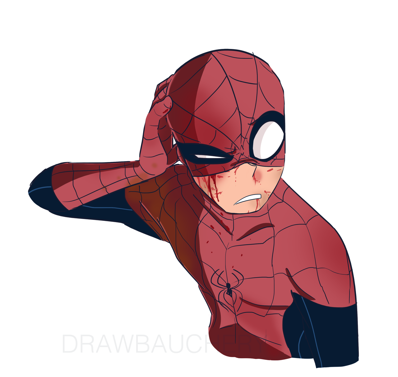 hurt