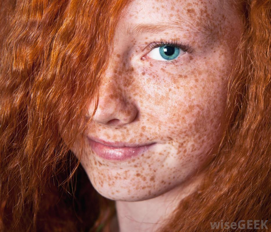 furrycollectionperson-things:Freckle face