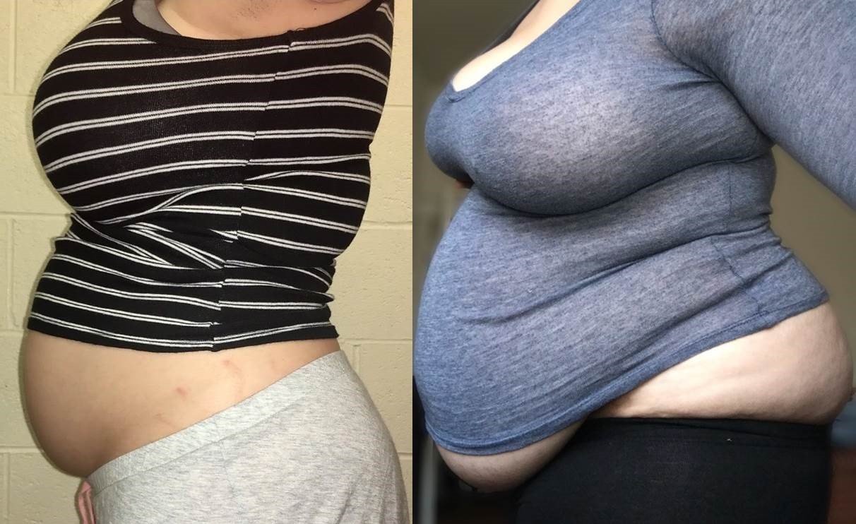 ffafeed: sammybellylove: Softiebabie - reason &amp; result  That’s me!!! :)