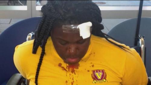 revolutionarykoolaid:Baltimore, Maryland – This week, a 13-year-old girl received 10 stitches in her head after she was attacked by police at Vanguard Middle School in Baltimore. The entire incident was caught on video and shows the school police officer