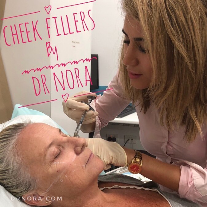 Anything is possible with an eye for perfection and a dermal filler! This lovely patient wanted to bring her cheeks back to life and reduce the signs of aging.
I’ve used 1ml of dermal filler in each cheek to give her cheekbones more structure and...