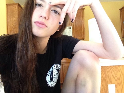west-coast-wasted:  Me ft. my mystery bruise