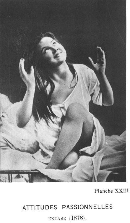 Éxtasis, fotografía por Jean Charcot de la serie de mujeres internadas en el Hospital 