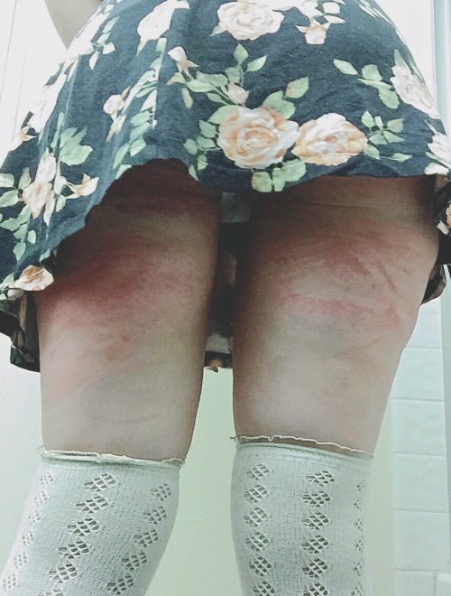 linnylace:  probably one of the best feelings in the world  That upskirt with the marks. Mmmmmm.