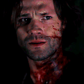 waywardsam:#my heart hurts #but also he’s so pretty