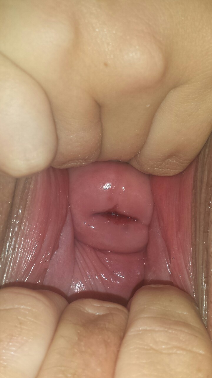 wrstdeeppussy:  stretchedcouple:  She discovered her ability to push her cervix almost