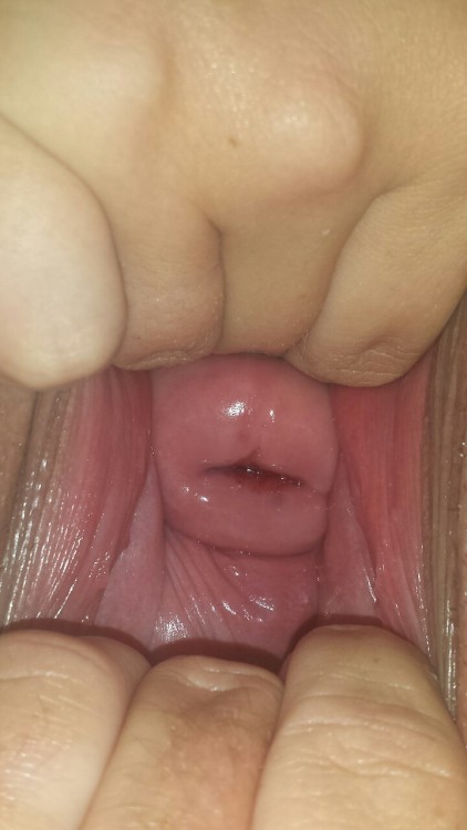 wrstdeeppussy:  stretchedcouple:  She discovered her ability to push her cervix almost all the way out!  Hot damn I’m so obsessed with the cervix push out. Its hard to do for most women. I’ve always wanted to lick a cervix. Stretchcouple  you two