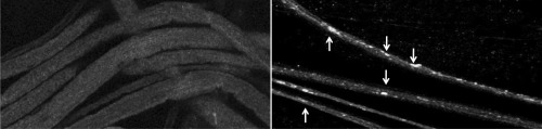 Porn neurosciencestuff:  How problems with an photos