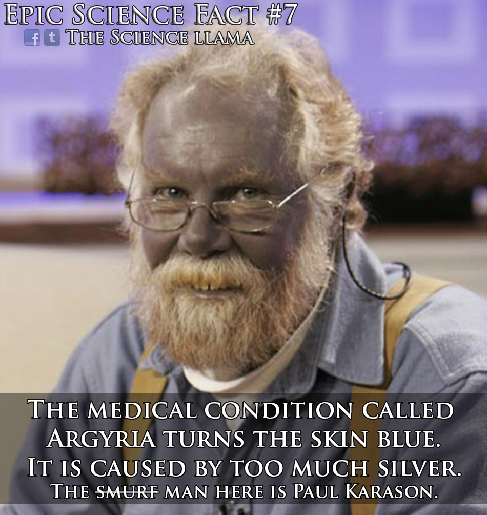 Argyria, the condition where your skin turns blue from too much silver intake.
The process that causes this is similar to developing black and white photographs. After the silver has gone through the digestive tract and lost/gained electrons it will...