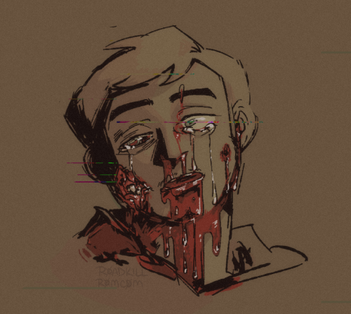 Incoherent Scribbling. Eye Trauma Is Preexisting. From Getting Whacked Over The Head W A Metal Pipe.