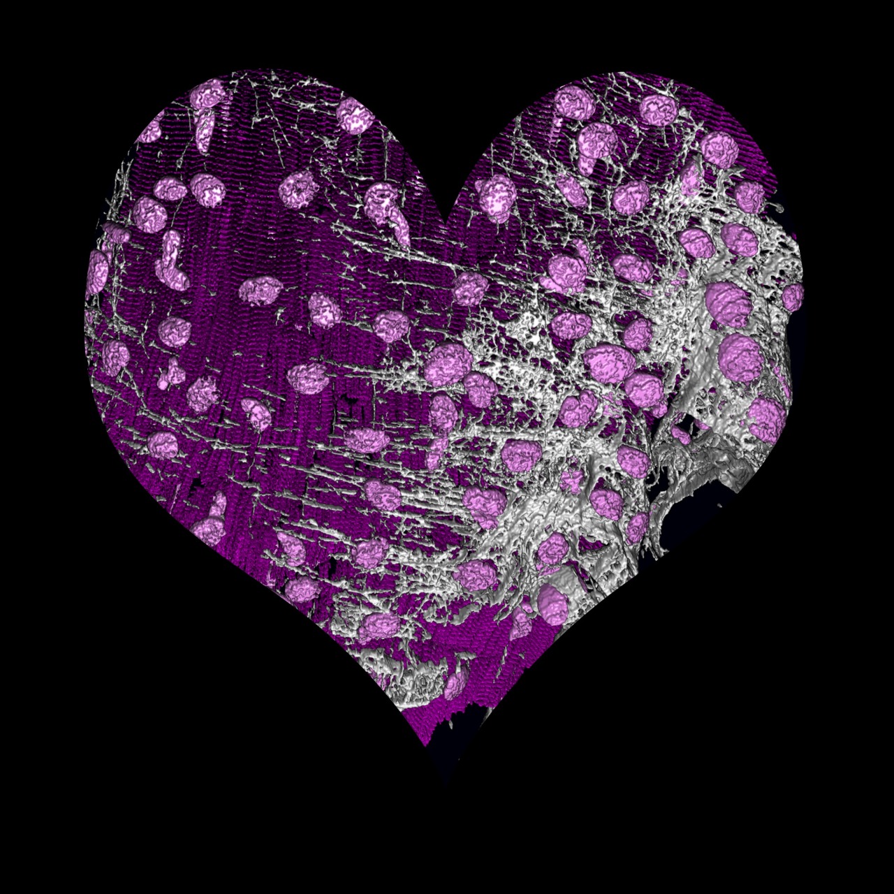 Helping mend broken hearts
UK researchers from the BBSRC-funded Babraham Institute have recently discovered how signalling processes within the heart can trigger the development of enlarged heart cells, a process called hypertrophy.
While this may...