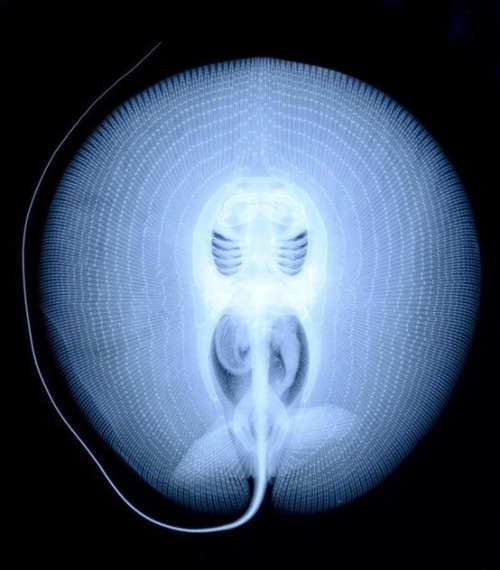 nudiemuse:  jellyfishtimes:  captainatlantic:  X-ray of a sting ray  Well that’s fun to say  This is fucking awesome. 