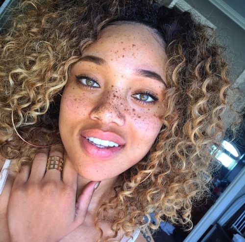 deerspace:forjeditorap:Glorious Melanin Your freckles give me goosebumps,you’re gorgeous