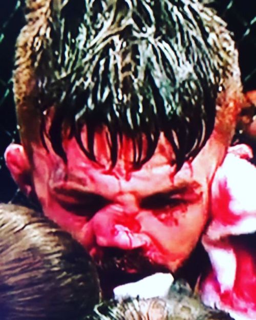 Ouch @platinummikeperry #ufcuruguay @whitebeltbjj @bjj.wiki @bjjdating @timspriggsbjj @redbowiecbd @