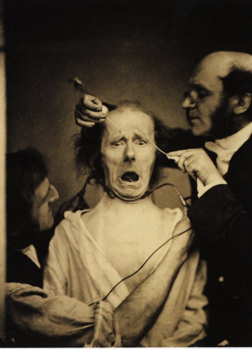 historicaltimes:Photo of neurologist Duchenne de Boulogne electrocuting a man’s face in order to stu