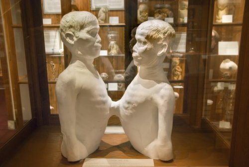 apodemus:  sixpenceee:  If you are into the bizarre and museums like me, than one place you NEED to visit is the Mutter Museum in Pennsylvania.  It’s a medical museum filled with oddities.  Some things it has are the body of the soap lady (1st picture).