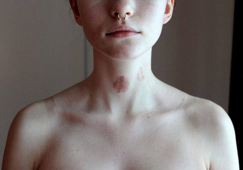 nopartynomambo:  Bruises | via Tumblr en We Heart It. 