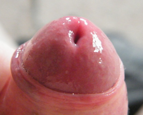 gallardocolour:Some real close ups of my small cocks head with some precum.