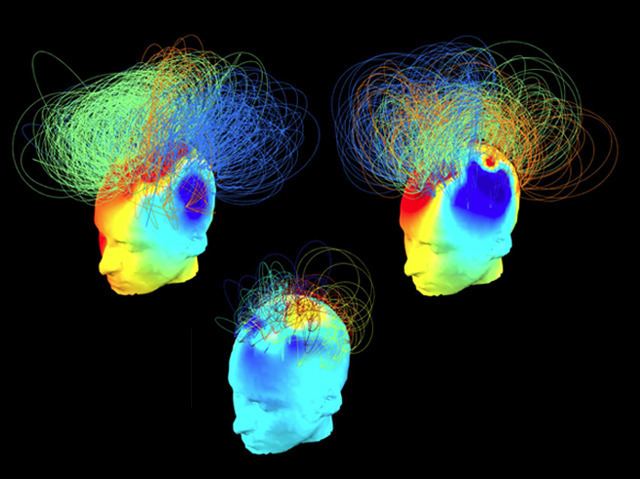 bpod-mrc:  22 October 2014 Conciousness Maps Angèle Lieby could hear her husband