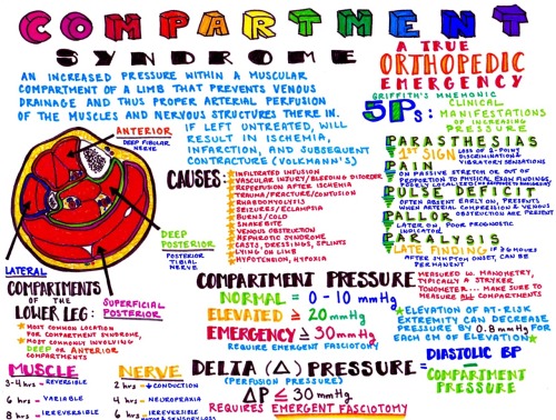 All you need to know about diagnosing compartment syndrome!!download all of my medical school cheat 