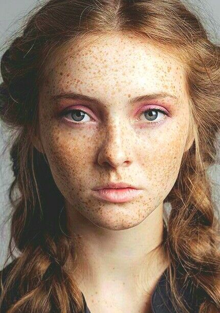 silentorgasm:  Lovely eyes, freckles.