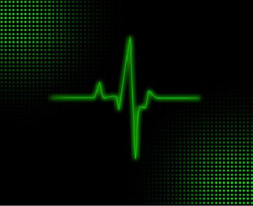 scienceyoucanlove:What is an EKG?An electrocardiogram (EKG or ECG) is a test that checks for problem