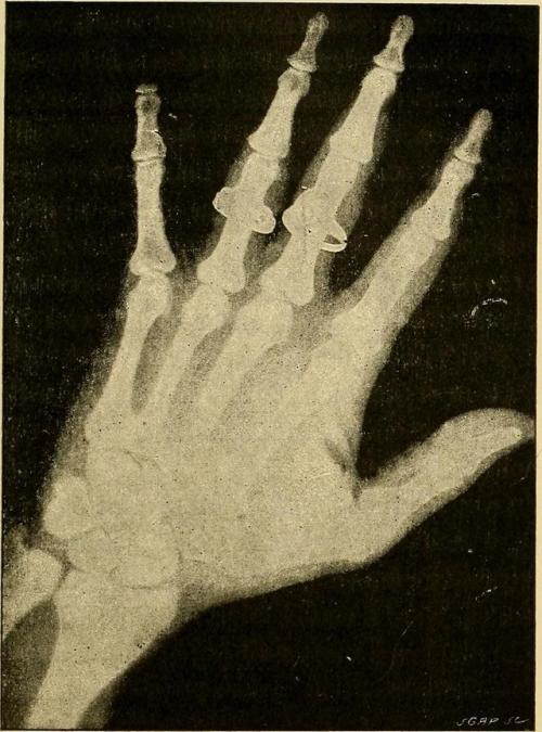 Traité de radiographie médicale et scientifique, 1897