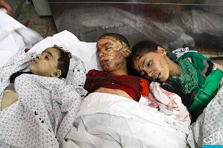 Gaza’s latest update: 572 Palestinians were killed and 3360 wounded