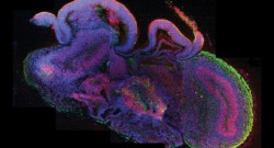 jtotheizzoe:  A Crude Model Of A Brain, Grown In A Lab You’re looking at a fluorescently-stained cross section of a cerebral organoid, a sort of crude “model brain” grown from stem cells. Austrian scientists were able to coax this complex structure