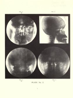 nemfrog:  Plate 2. An x-ray atlas of the