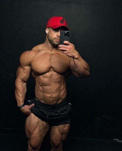 Josh Andrew And His Stonking Calves.