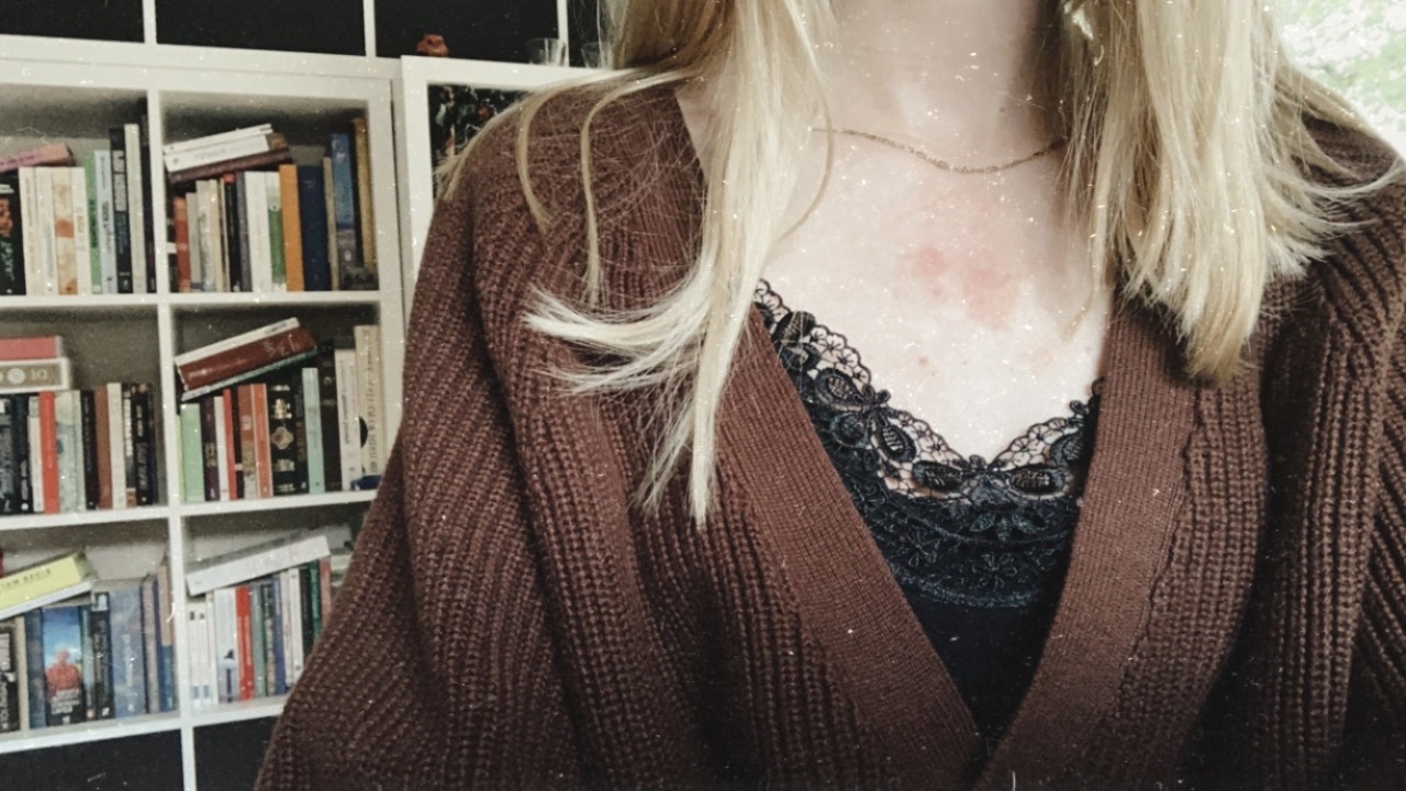 medusastears:Me ft my eczema porn pictures