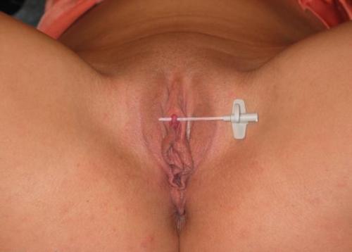 Clit pierced, ready for a ring. adult photos