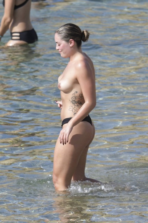 heathenhole:   Olympia Valance Topless  On Holiday Mykonos Beach - Yes she had breast reduction, thus the scars.