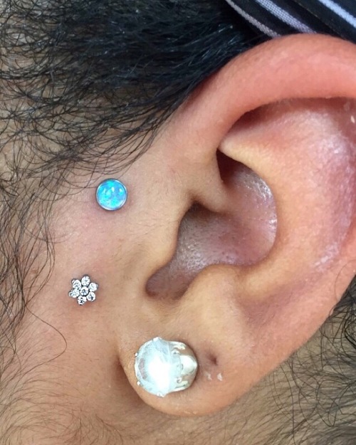 Healed surface piercing with titanium jewelry by Anatometal