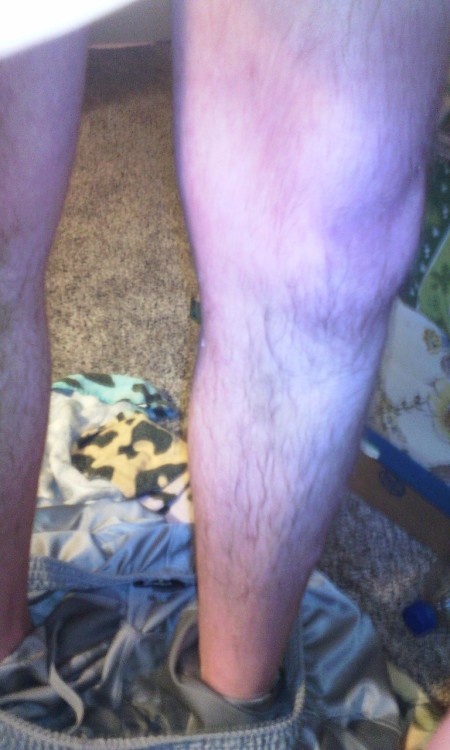 davegaz123:I had an accident… 2 liters of water and 2 hours and 15 minutes since my last bathroom break, and this is what happens…. I started to soak my shorts, pee was running down my legs… But I got most of the flood contained in a cup… 