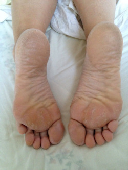 ROUGH SOLES