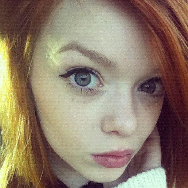  Lass and her freckles &lt;3 