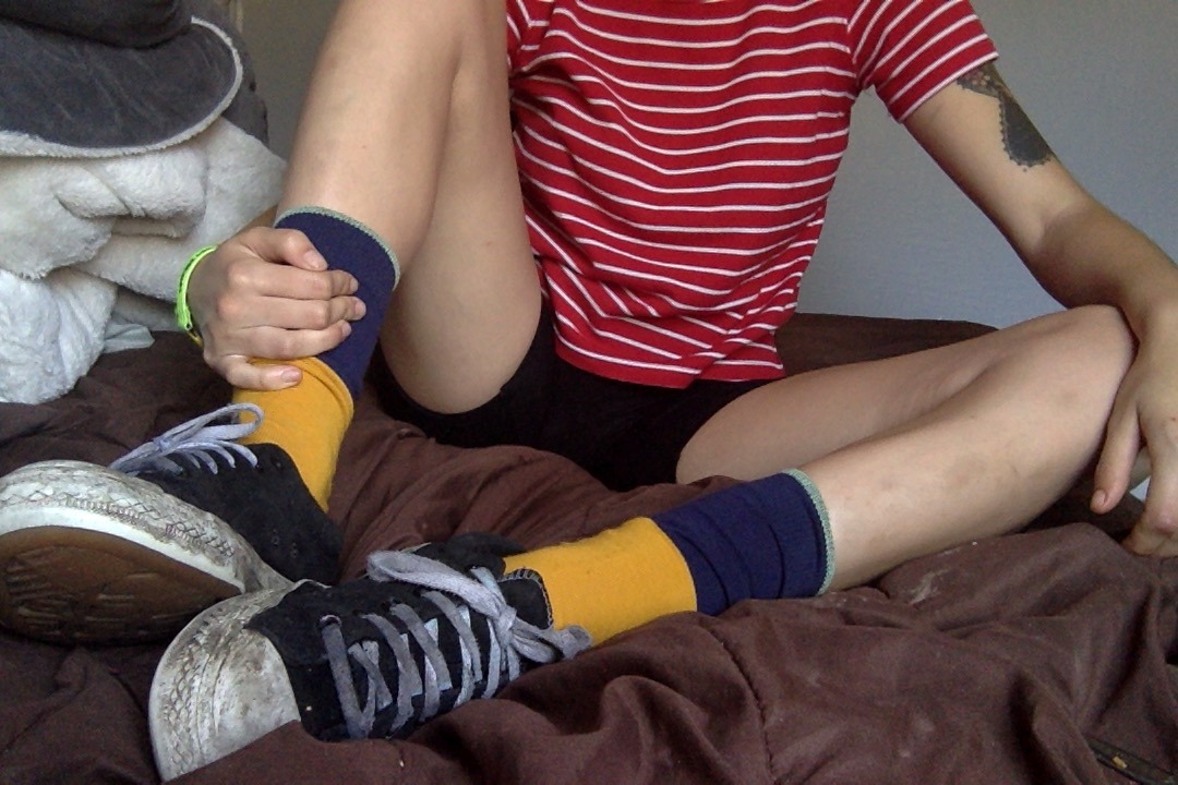 succuletus:  aesthetic: post-80s dodgeball montage bruises 