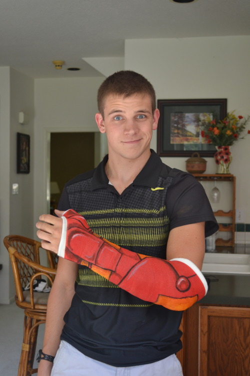ishipitlikeups: lauradefazio: My little brother broke his tiny bone in his wrist that does not heal 