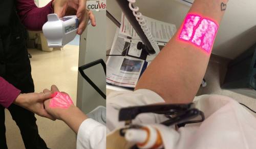 This device uses infrared technology to help find veins How? Well it works in a similar way to pulse