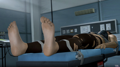 thedickgrillsurgeon:  –WARNING: JUST FEET– full set:http://imgur.com/a/Ozesb 