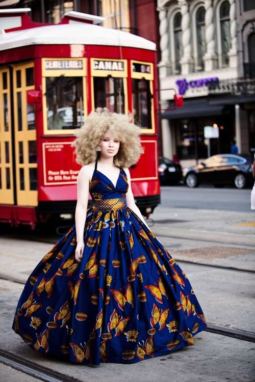 the-girl-with-albinism: Happy International Albinism Awareness Day 2016 because my black is beautifu