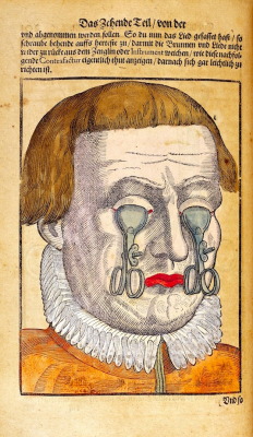 hushaby:  Jeepers Creepers: Surreal illustrations of witchcraft-caused eye diseases from the 16th century | 