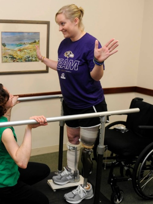 Boston Marathon bombing victim gets new leg