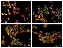 mucholderthen:  Stress Granules Microphotography by ~lady-alessandra Stress granules are ribonucleoprotein structures that form in cell cytoplasm under stress conditions. Their function is still not completely clear, but it is known that stress response