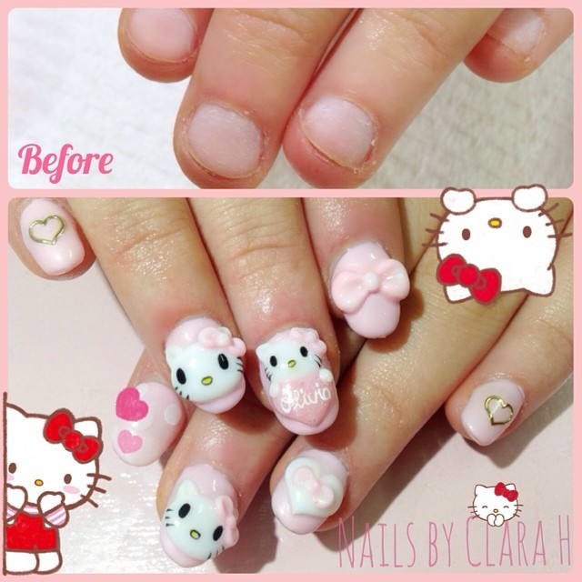 OHAI!! Another before-after nail biter set. Olivia wanted Hello Kitty all over her new extensions! #acrylicnails #boxhill #boxhillnails #clarahnails #hellokittynails #sanrio #japanesenailart #melbournenailart #melbournenailstudio #nailartmelbourne...