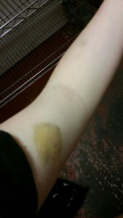 One of the first bruises my Owner ever gave me. Such a good looking bite mark! Of course, this was t