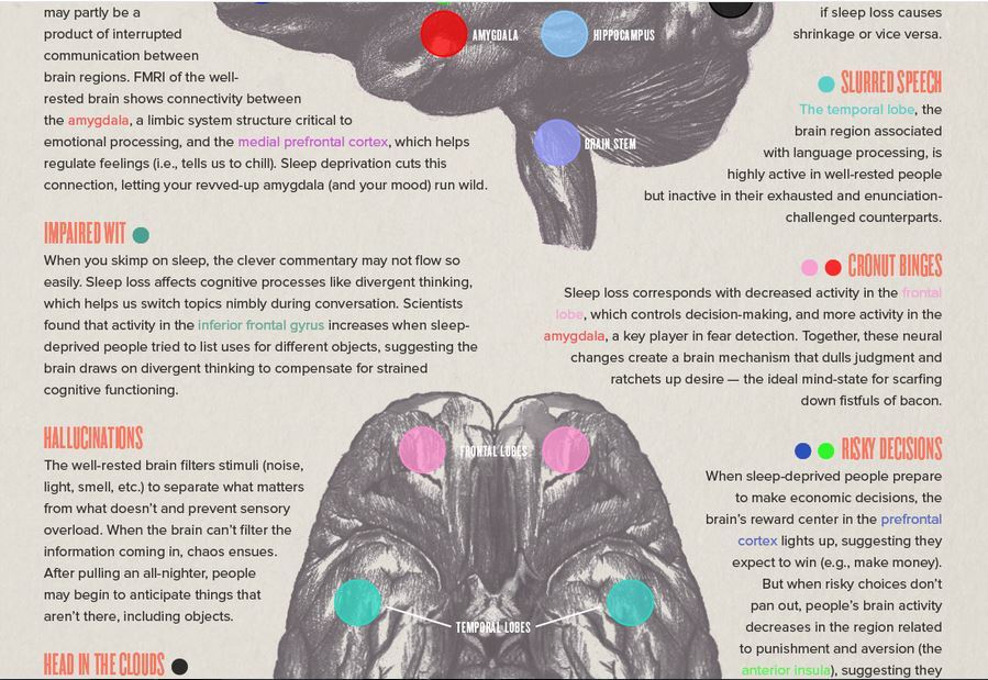 sixpenceee:  What Happens When Your Brain Doesn’t Sleep?(Source)